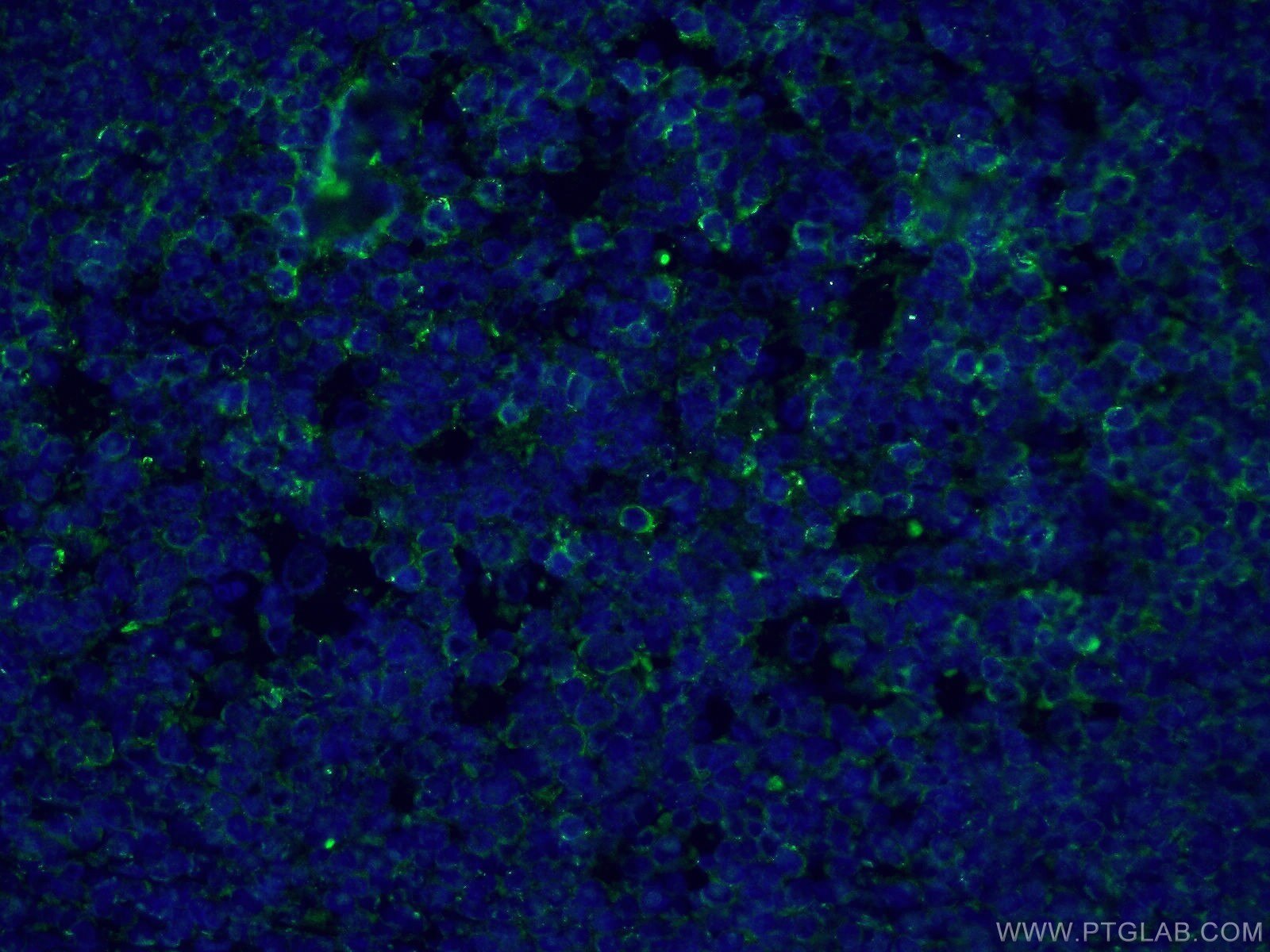 Immunofluorescence (IF) / fluorescent staining of human tonsillitis tissue using PD-1/CD279 Polyclonal antibody (18106-1-AP)