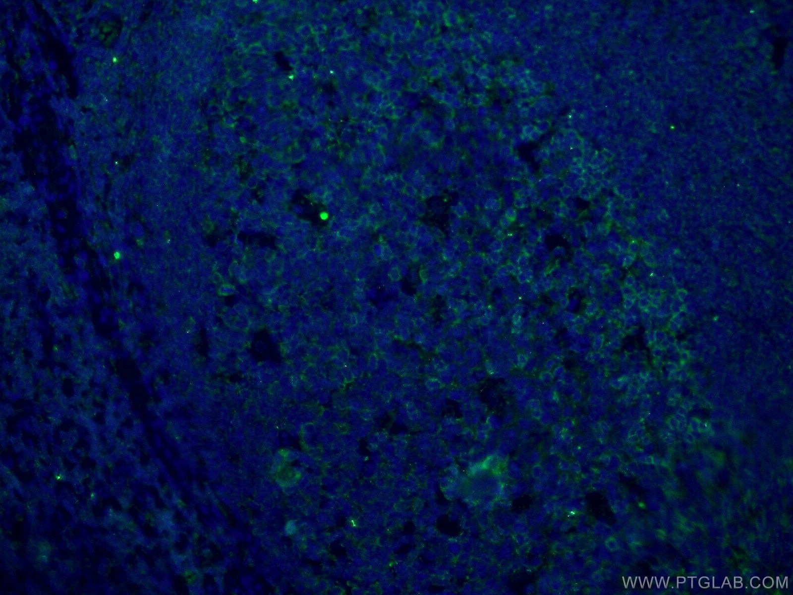 Immunofluorescence (IF) / fluorescent staining of human tonsillitis tissue using PD-1/CD279 Polyclonal antibody (18106-1-AP)