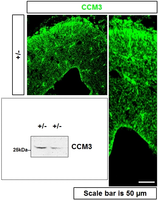 IF Staining of mouse brain using 10294-2-AP