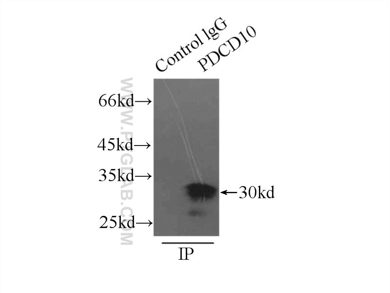 IP experiment of mouse skeletal muscle using 10294-2-AP