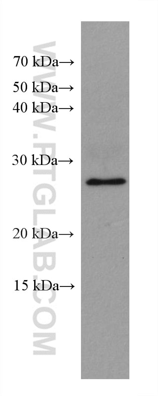 Western Blot (WB) analysis of Jurkat cells using CCM3/PDCD10 Monoclonal antibody (66440-1-Ig)