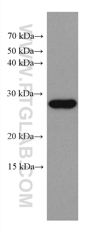 Western Blot (WB) analysis of human peripheral blood platelets using CCM3/PDCD10 Monoclonal antibody (66440-1-Ig)