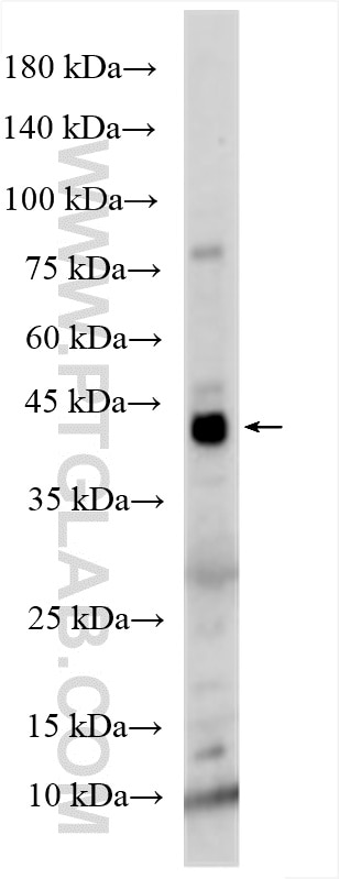 WB analysis of mouse heart using 18251-1-AP