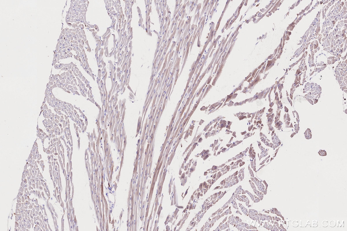 Immunohistochemistry (IHC) staining of mouse heart tissue using PD-L2/CD273 Polyclonal antibody (27406-1-AP)