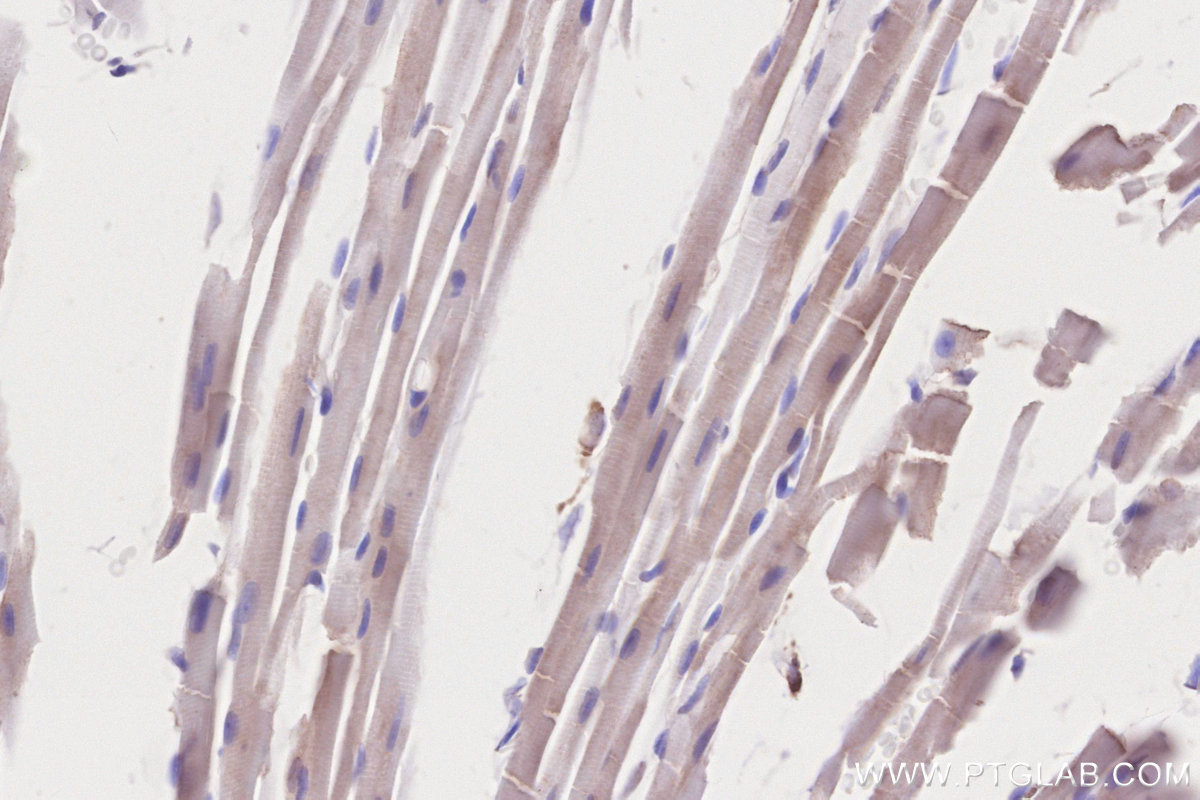 Immunohistochemistry (IHC) staining of mouse heart tissue using PD-L2/CD273 Polyclonal antibody (27406-1-AP)
