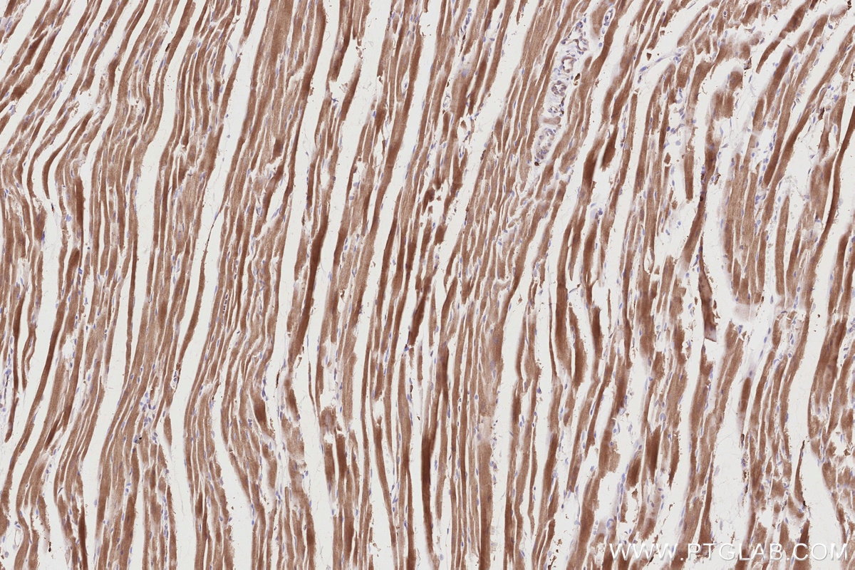 Immunohistochemistry (IHC) staining of rat heart tissue using PD-L2/CD273 Polyclonal antibody (27406-1-AP)