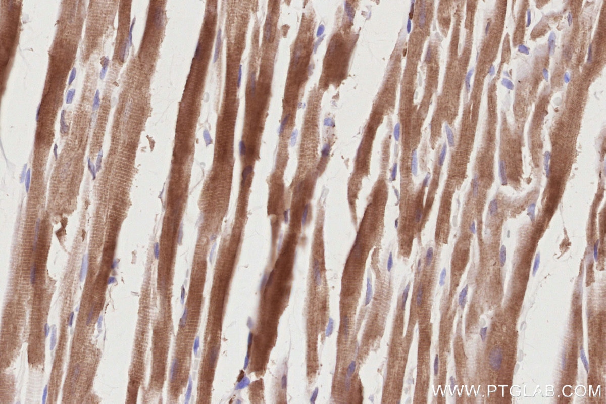 Immunohistochemistry (IHC) staining of rat heart tissue using PD-L2/CD273 Polyclonal antibody (27406-1-AP)