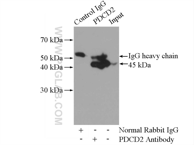 IP experiment of HeLa using 10725-1-AP