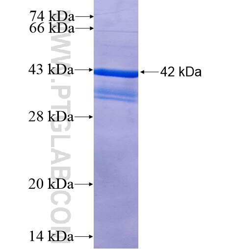 PDCD2 fusion protein Ag1139 SDS-PAGE
