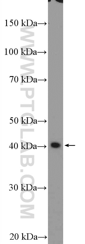 Western Blot (WB) analysis of mouse colon tissue using PDCD2L Polyclonal antibody (20781-1-AP)