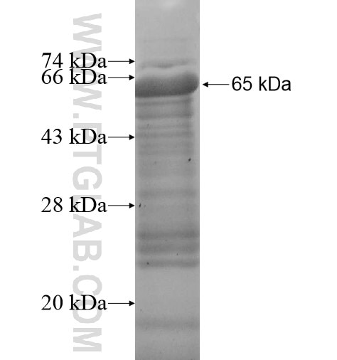 PDCD2L fusion protein Ag14795 SDS-PAGE