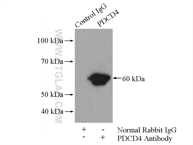 Immunoprecipitation (IP) experiment of HeLa cells using PDCD4 Polyclonal antibody (12587-1-AP)