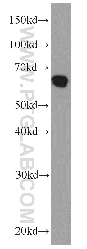 WB analysis of MCF-7 using 12587-1-AP