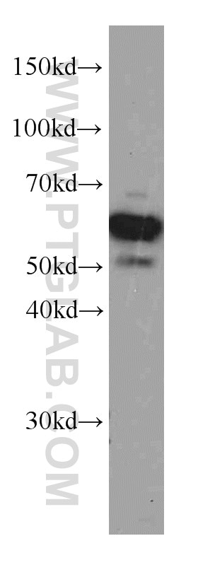 Western Blot (WB) analysis of Jurkat cells using PDCD4 Monoclonal antibody (66100-1-Ig)