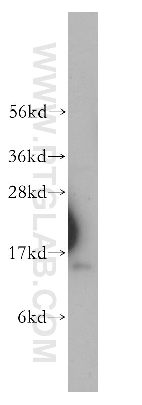 Western Blot (WB) analysis of human brain tissue using PDCD5 Polyclonal antibody (12456-1-AP)