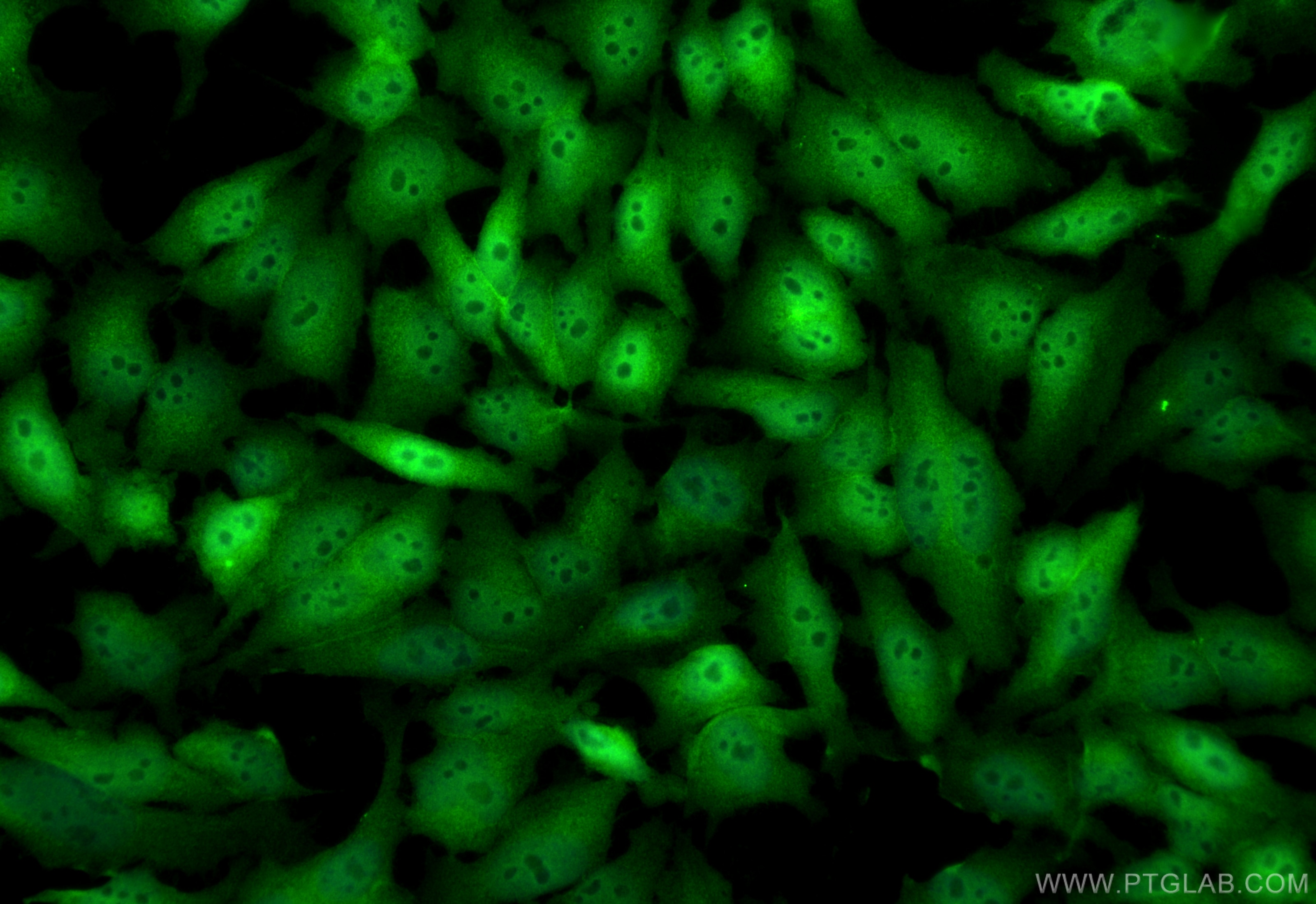 Immunofluorescence (IF) / fluorescent staining of HeLa cells using PDCD6/ALG2 Polyclonal antibody (12303-1-AP)
