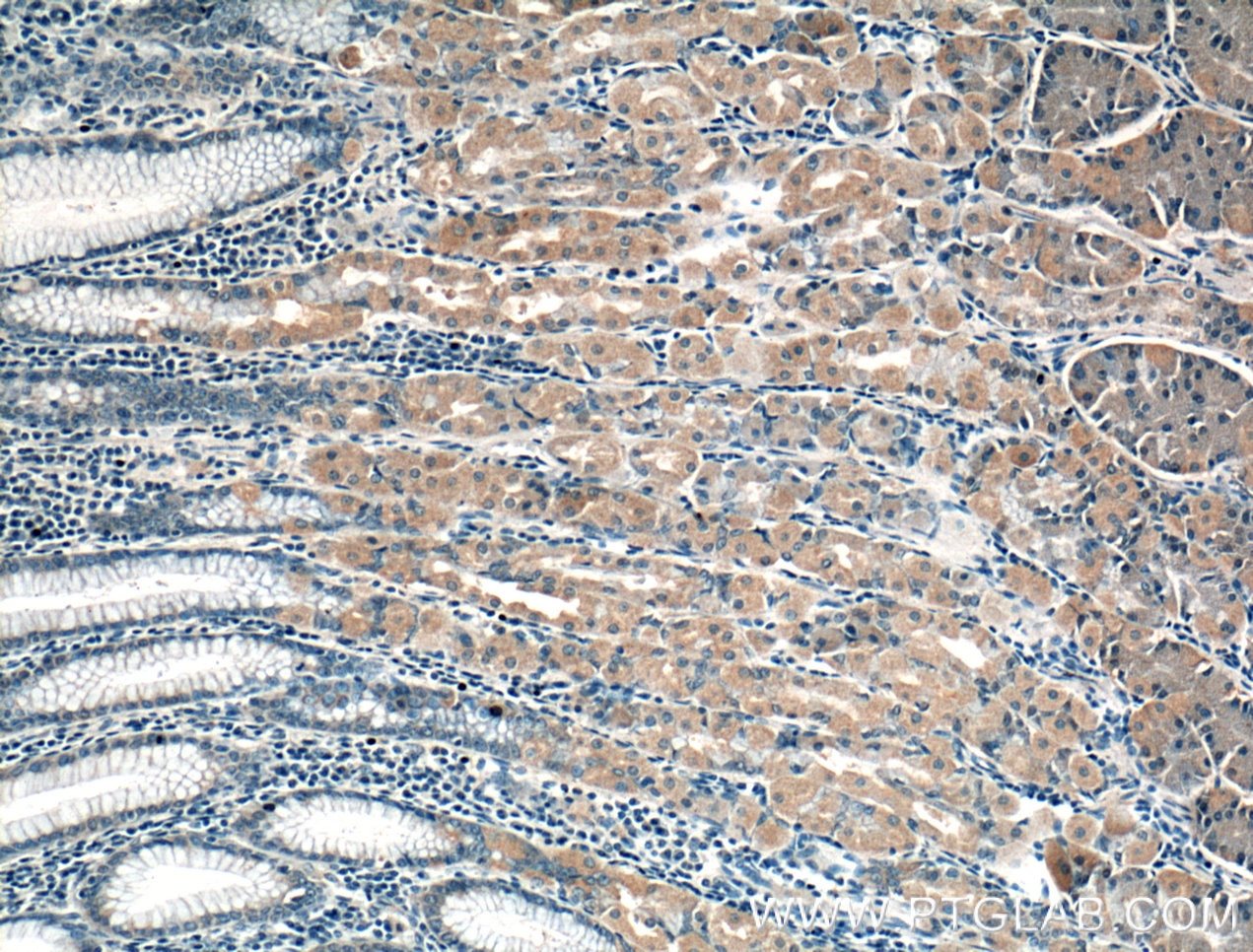 Immunohistochemistry (IHC) staining of human stomach tissue using PDCD6 Polyclonal antibody (12303-1-AP)