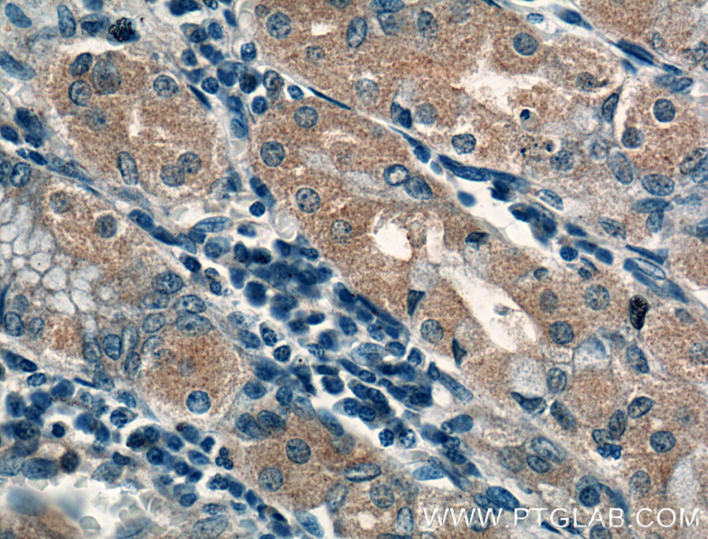 Immunohistochemistry (IHC) staining of human stomach tissue using PDCD6 Polyclonal antibody (12303-1-AP)