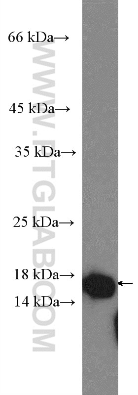 Western Blot (WB) analysis of Jurkat cells using PDCD6 Polyclonal antibody (12303-1-AP)