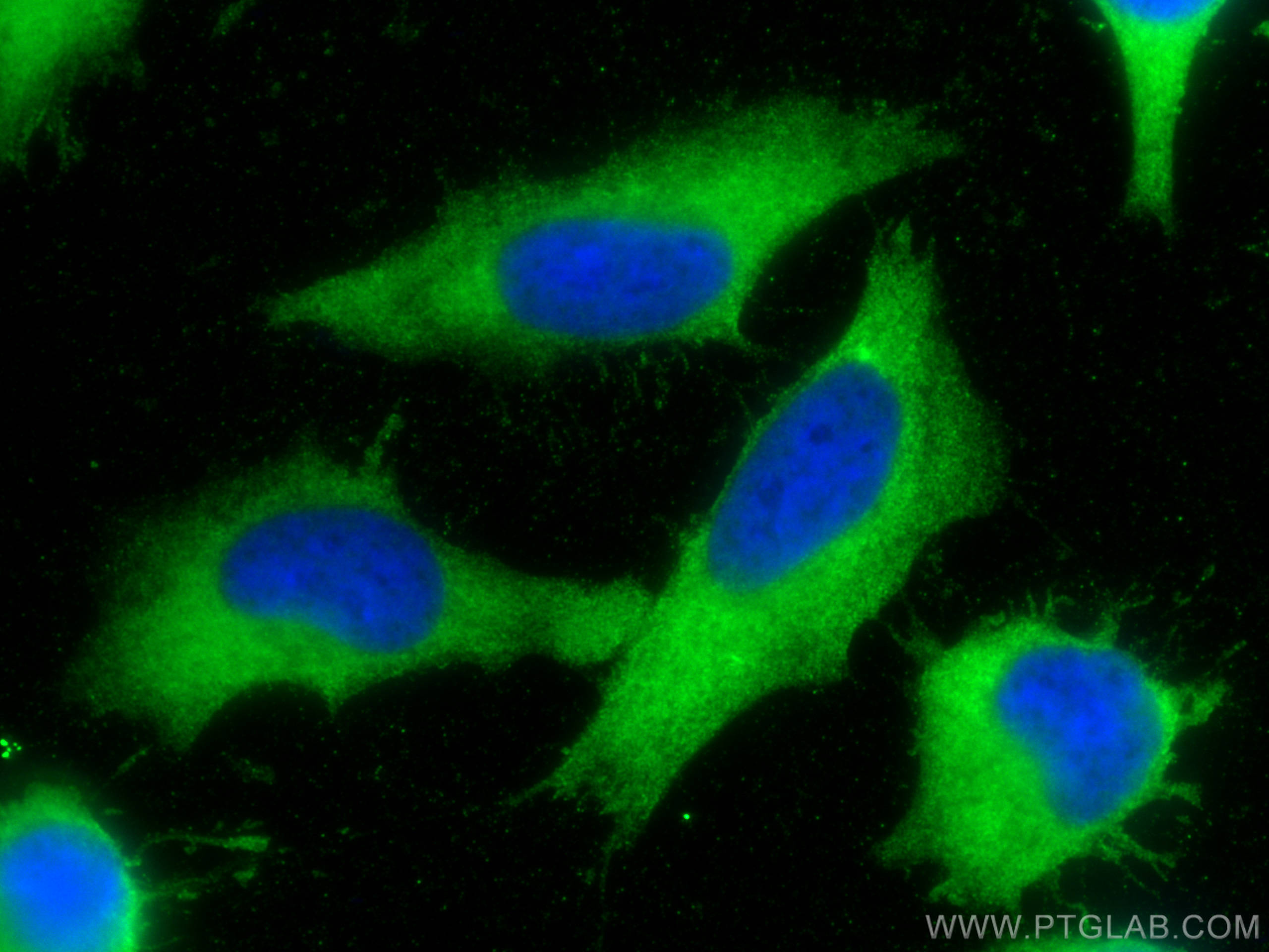 Immunofluorescence (IF) / fluorescent staining of HeLa cells using Alix Polyclonal antibody (12422-1-AP)