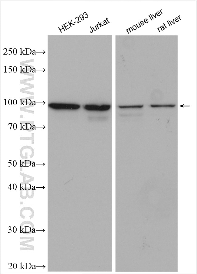 Western Blot (WB) analysis of various lysates using Alix Polyclonal antibody (12422-1-AP)