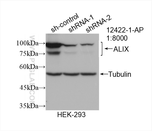 Western Blot (WB) analysis of HEK-293 cells using Alix Polyclonal antibody (12422-1-AP)