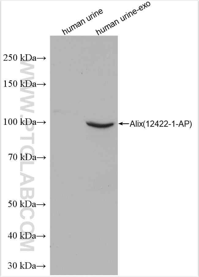 Western Blot (WB) analysis of various lysates using Alix Polyclonal antibody (12422-1-AP)