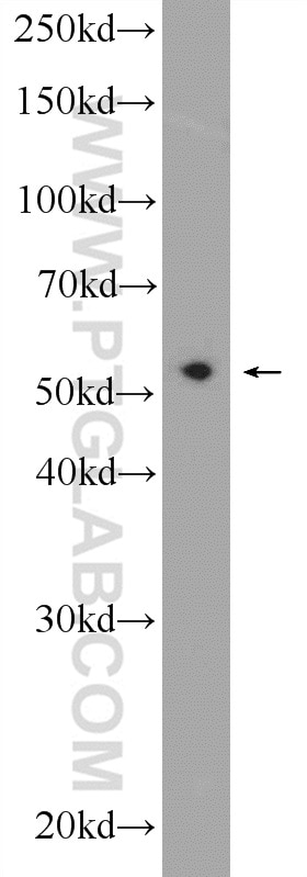 Western Blot (WB) analysis of HeLa cells using PDCD7 Polyclonal antibody (12485-1-AP)