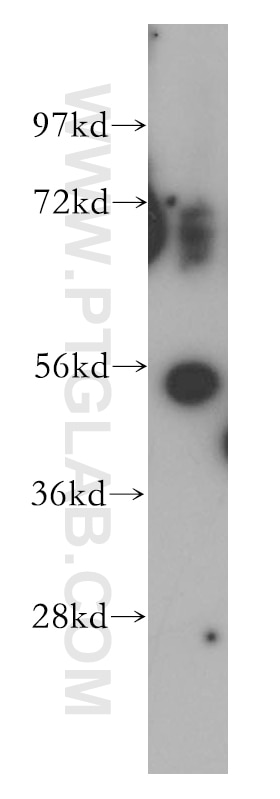 Western Blot (WB) analysis of Jurkat cells using PDCD7 Polyclonal antibody (12485-1-AP)