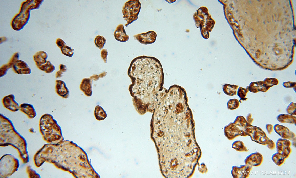 Immunohistochemistry (IHC) staining of human placenta tissue using PDCL Polyclonal antibody (16057-1-AP)
