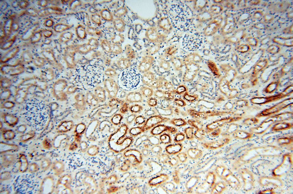 Immunohistochemistry (IHC) staining of human kidney tissue using PDCL2 Polyclonal antibody (17407-1-AP)