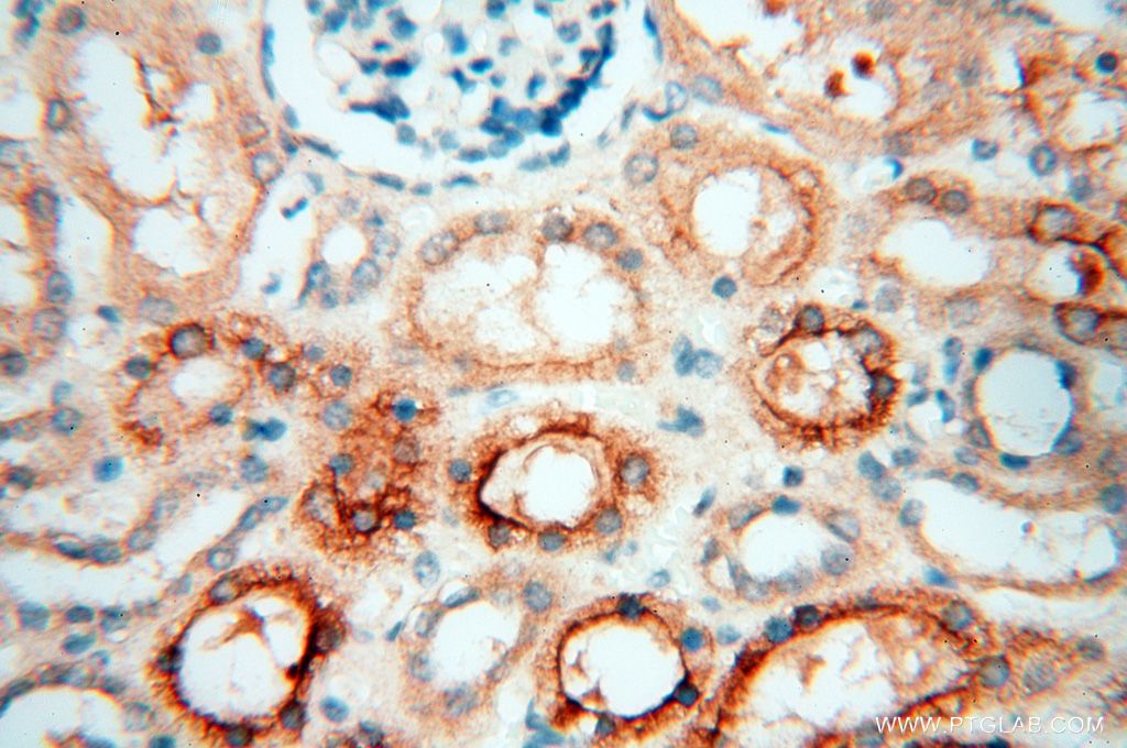 Immunohistochemistry (IHC) staining of human kidney tissue using PDCL2 Polyclonal antibody (17407-1-AP)