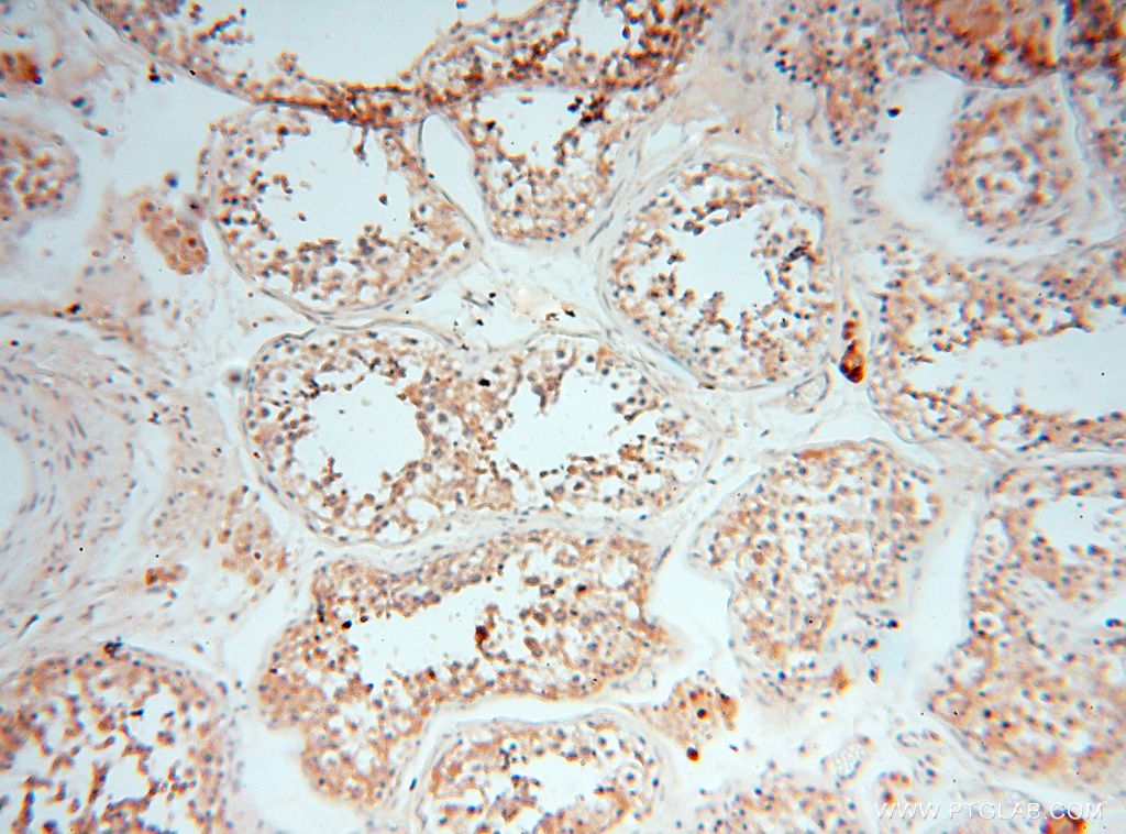 Immunohistochemistry (IHC) staining of human testis tissue using PDCL2 Polyclonal antibody (17407-1-AP)