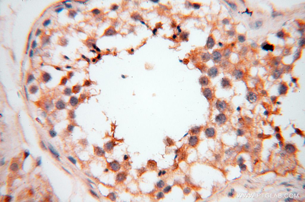 Immunohistochemistry (IHC) staining of human testis tissue using PDCL2 Polyclonal antibody (17407-1-AP)