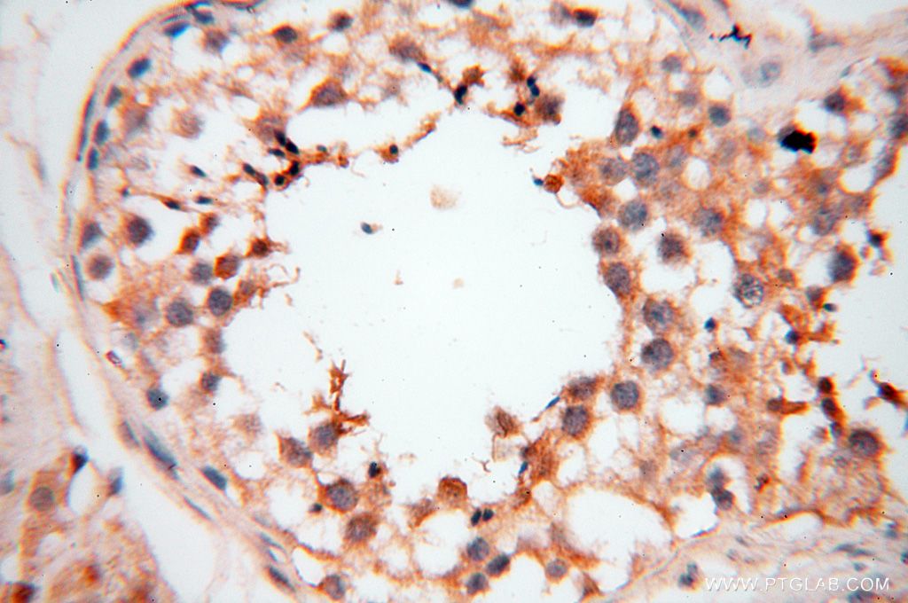 IHC staining of human testis using 17407-1-AP