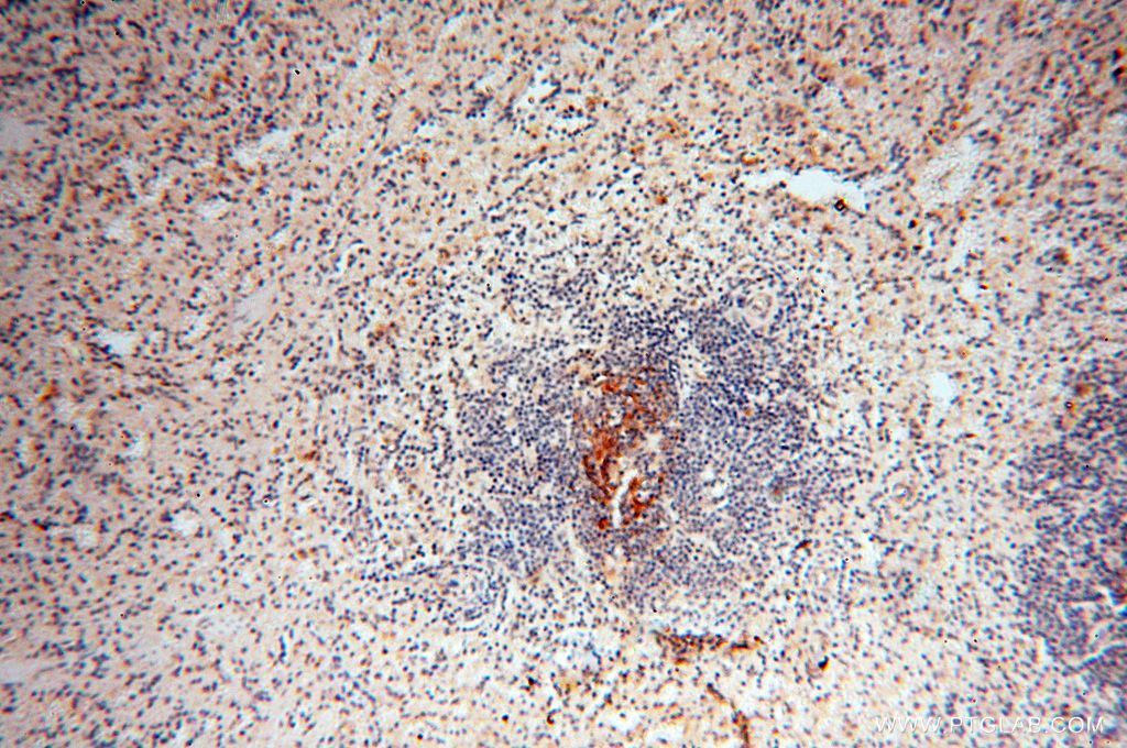 Immunohistochemistry (IHC) staining of human spleen tissue using PDCL2 Polyclonal antibody (17407-1-AP)