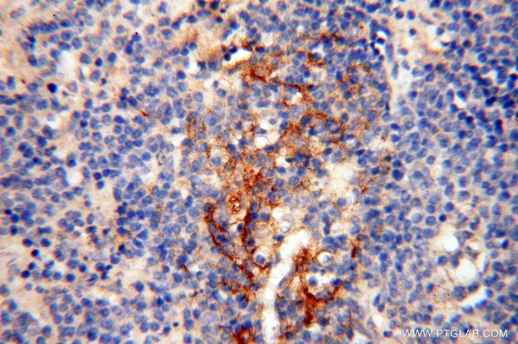 Immunohistochemistry (IHC) staining of human spleen tissue using PDCL2 Polyclonal antibody (17407-1-AP)