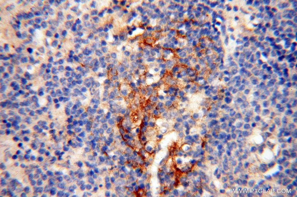 IHC staining of human spleen using 17407-1-AP