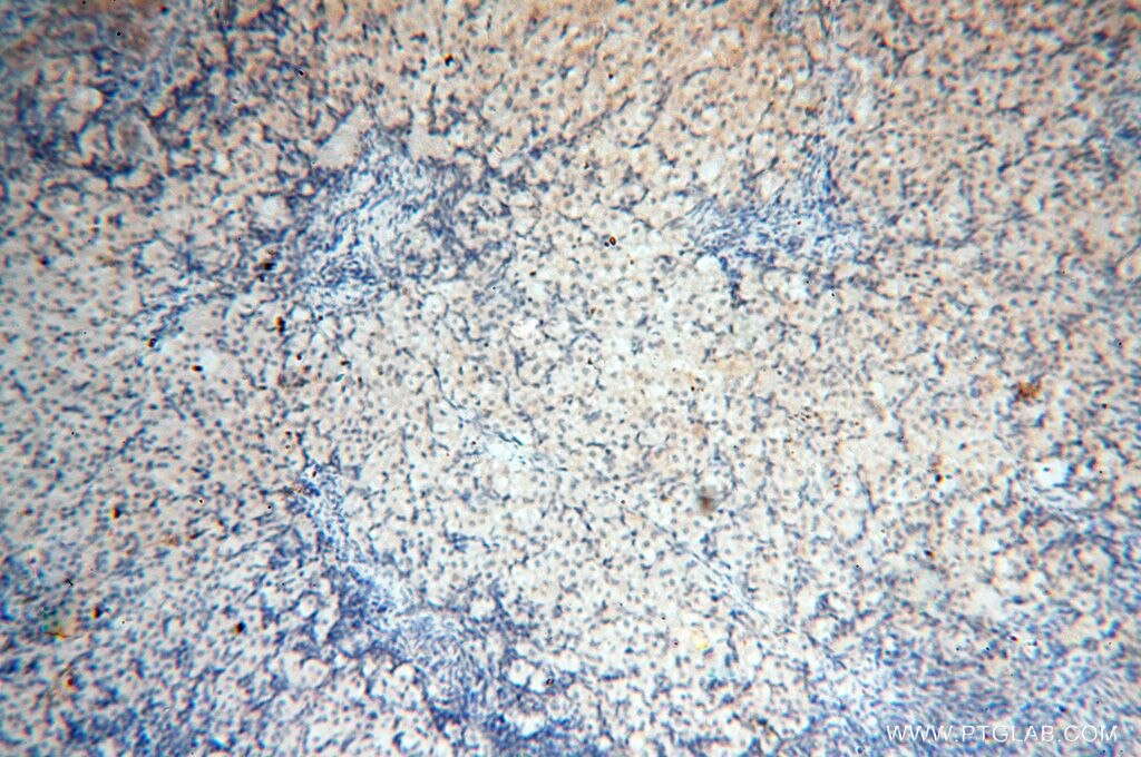 IHC staining of human ovary using 17407-1-AP