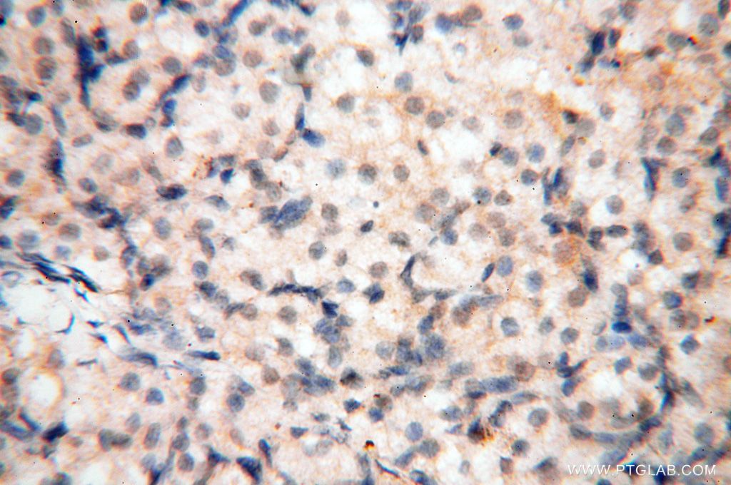 Immunohistochemistry (IHC) staining of human ovary tissue using PDCL2 Polyclonal antibody (17407-1-AP)