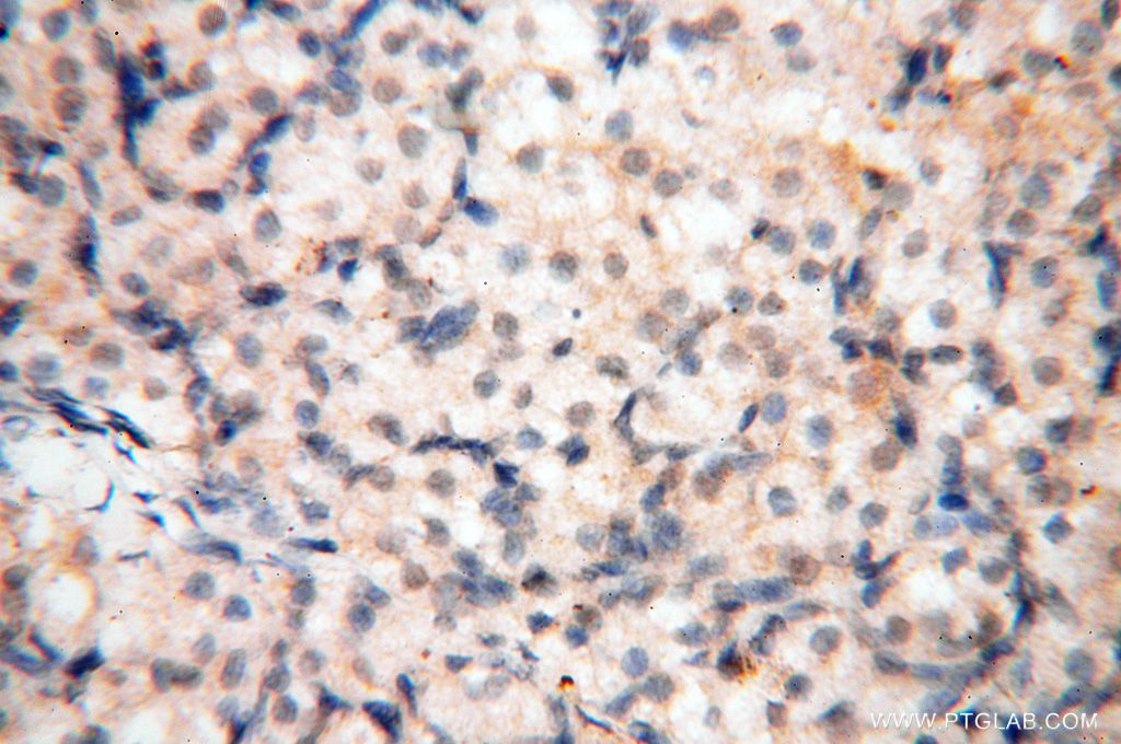 IHC staining of human ovary using 17407-1-AP