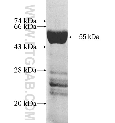PDCL2 fusion protein Ag11427 SDS-PAGE