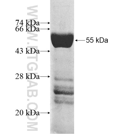 PDCL2 fusion protein Ag11427 SDS-PAGE