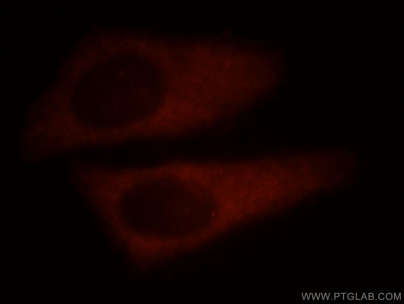 IF Staining of HepG2 using 14997-1-AP