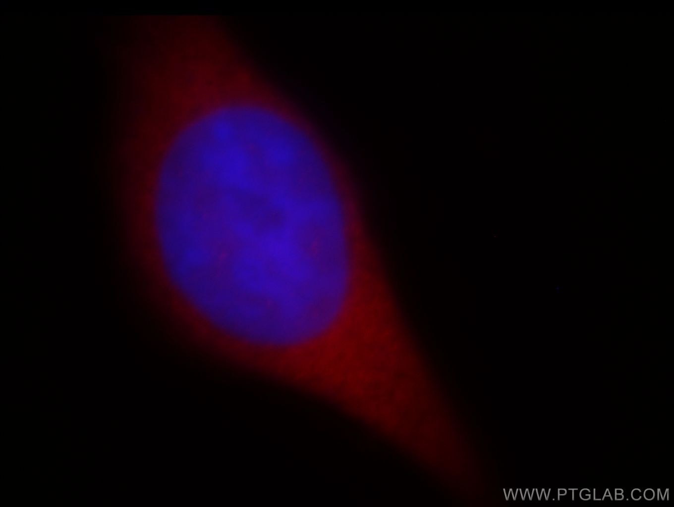 IF Staining of MCF-7 using 14997-1-AP