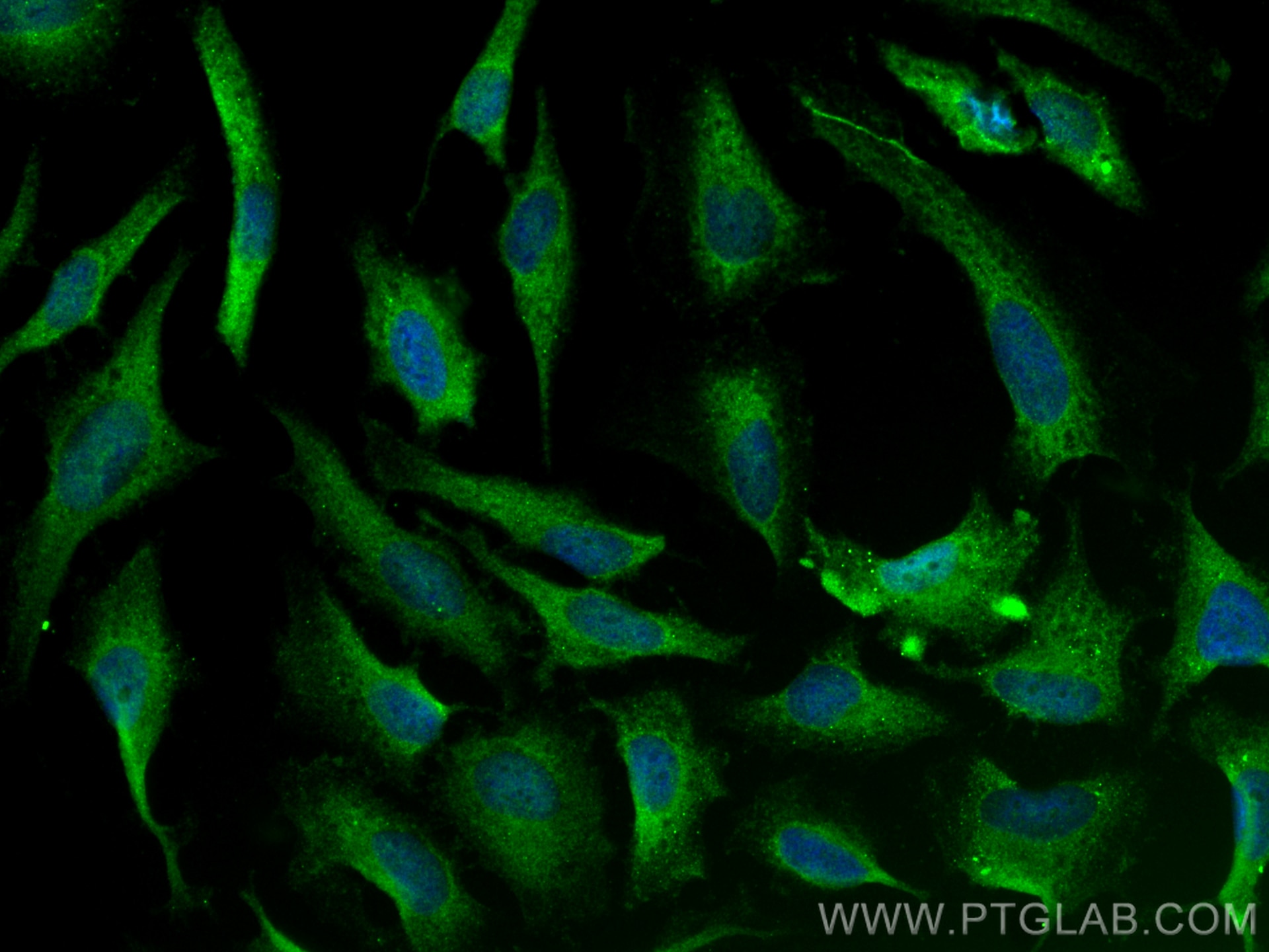 Immunofluorescence (IF) / fluorescent staining of HeLa cells using PDE10A Polyclonal antibody (18078-1-AP)