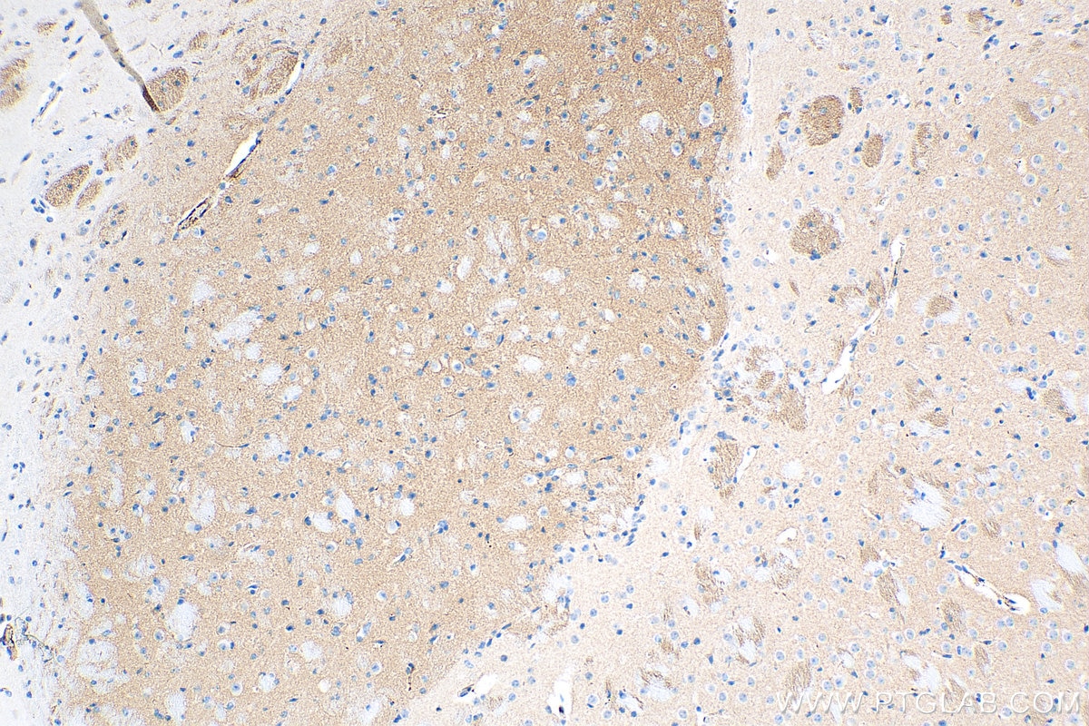 Immunohistochemistry (IHC) staining of mouse brain tissue using PDE10A Polyclonal antibody (18078-1-AP)