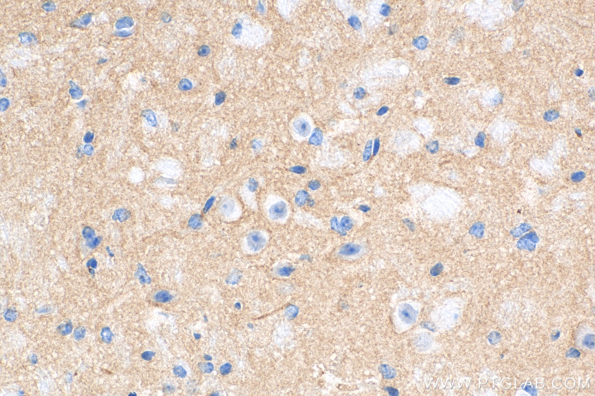 Immunohistochemistry (IHC) staining of mouse brain tissue using PDE10A Polyclonal antibody (18078-1-AP)