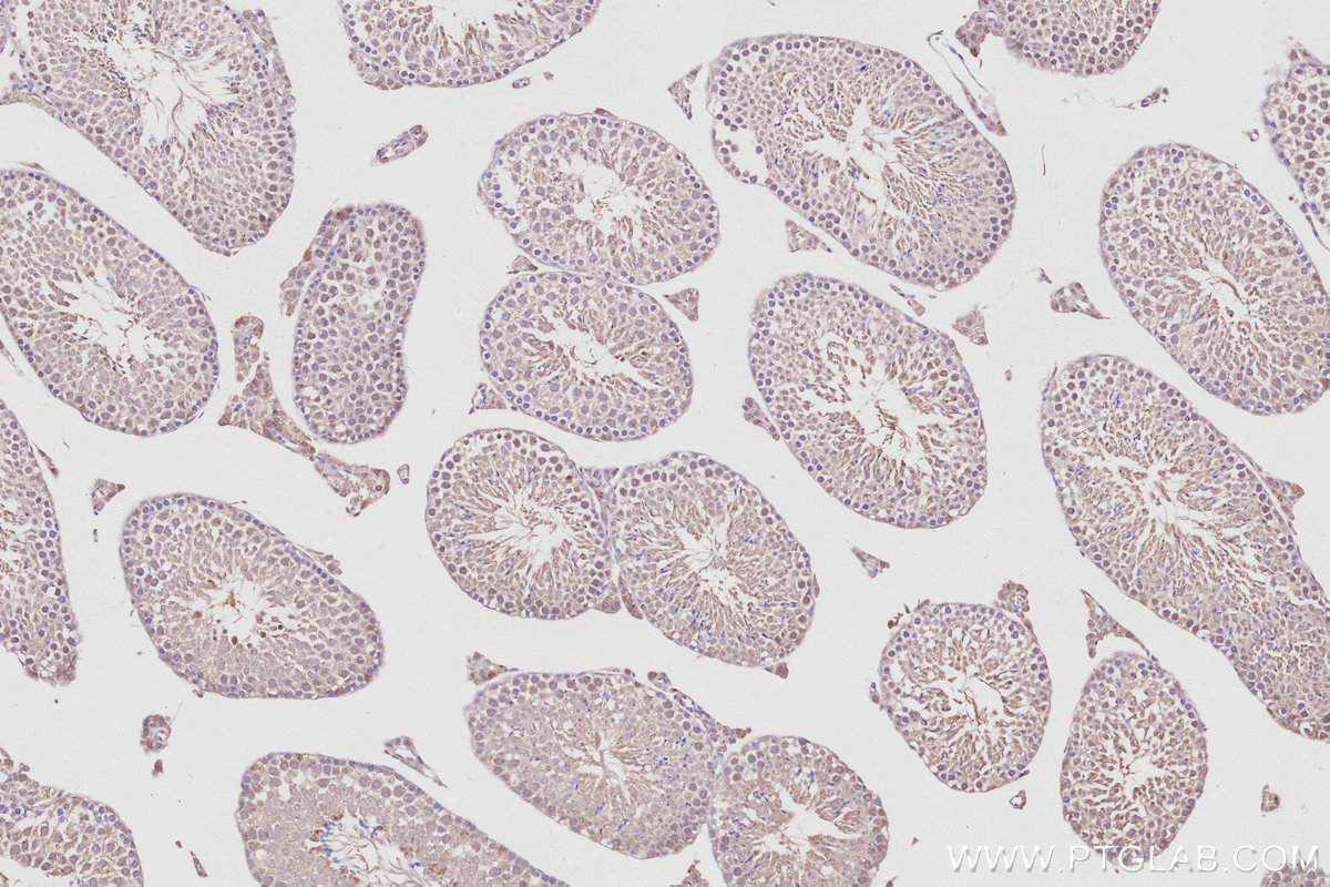 Immunohistochemistry (IHC) staining of mouse testis tissue using PDE10A Polyclonal antibody (18078-1-AP)