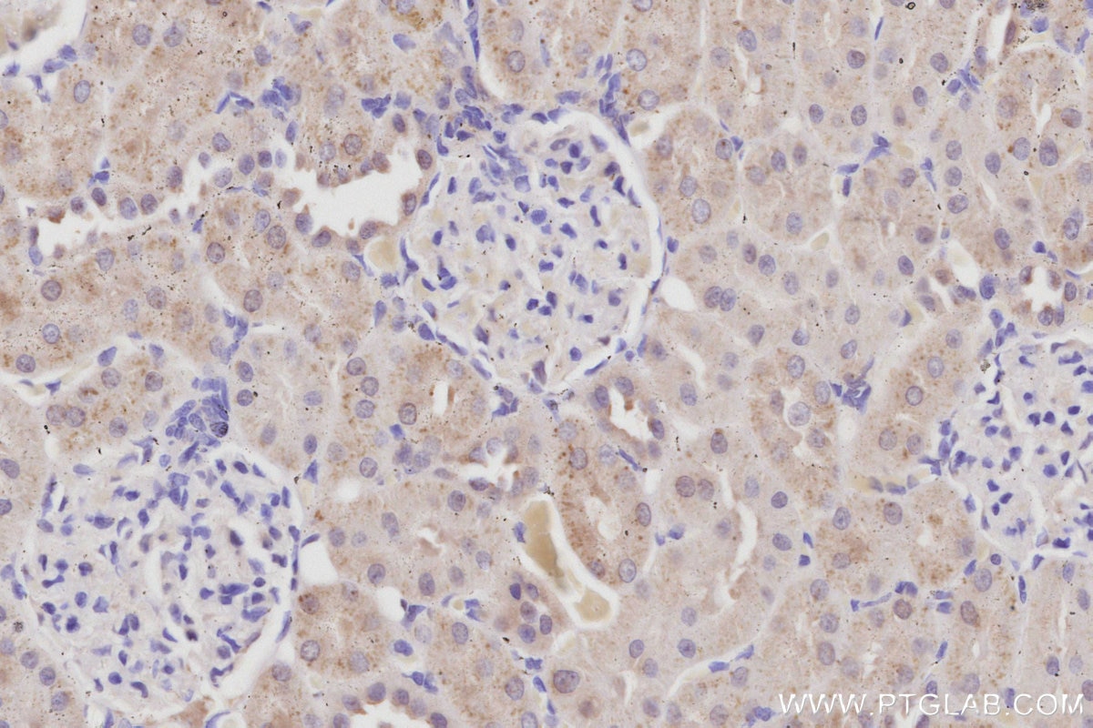 Immunohistochemistry (IHC) staining of rat kidney tissue using PDE10A Polyclonal antibody (18078-1-AP)